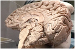 Neurosurgery Education and Training School Neurosurgery Education and Training School photo 2